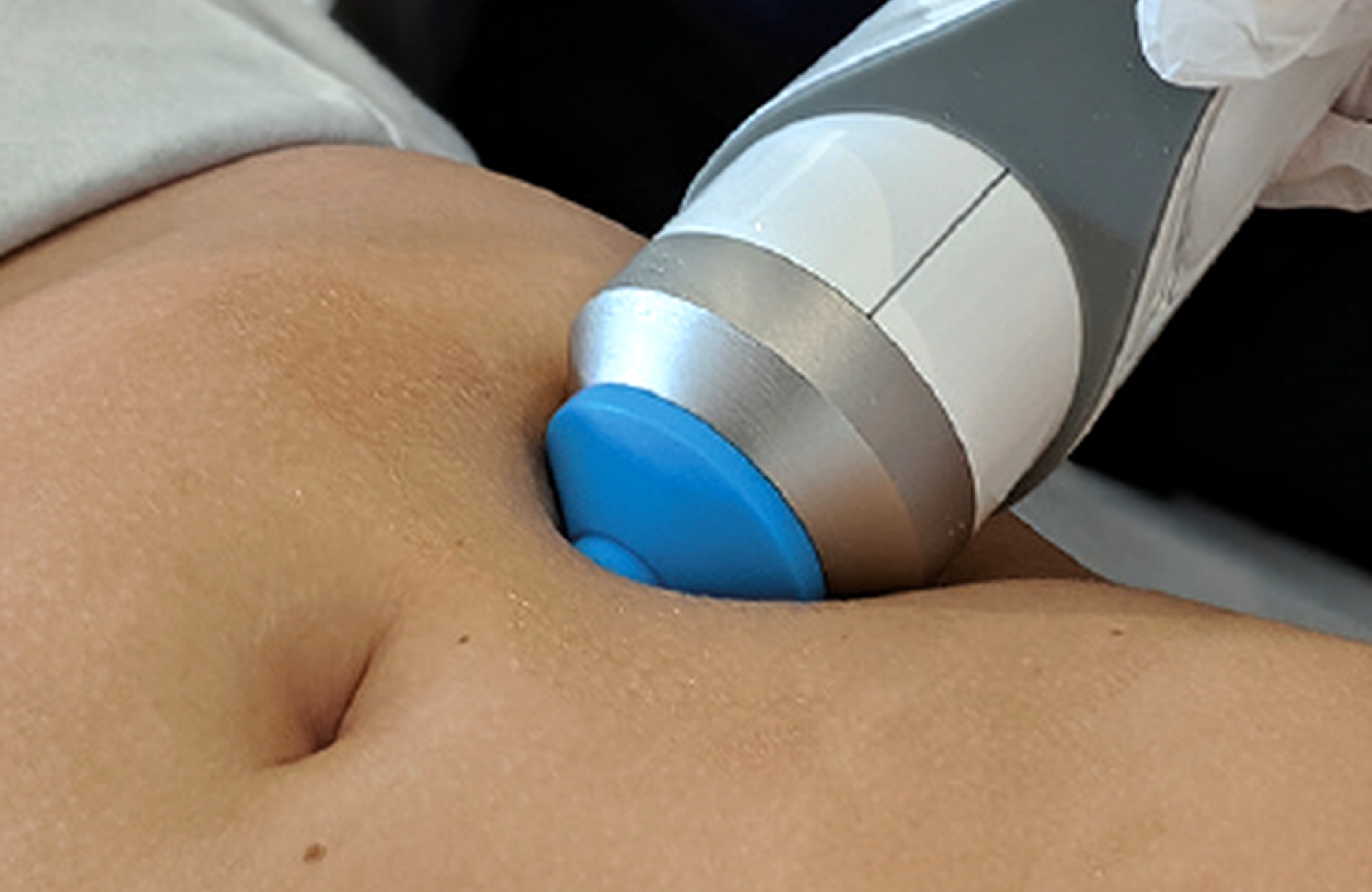 3D Body Contouring treatment