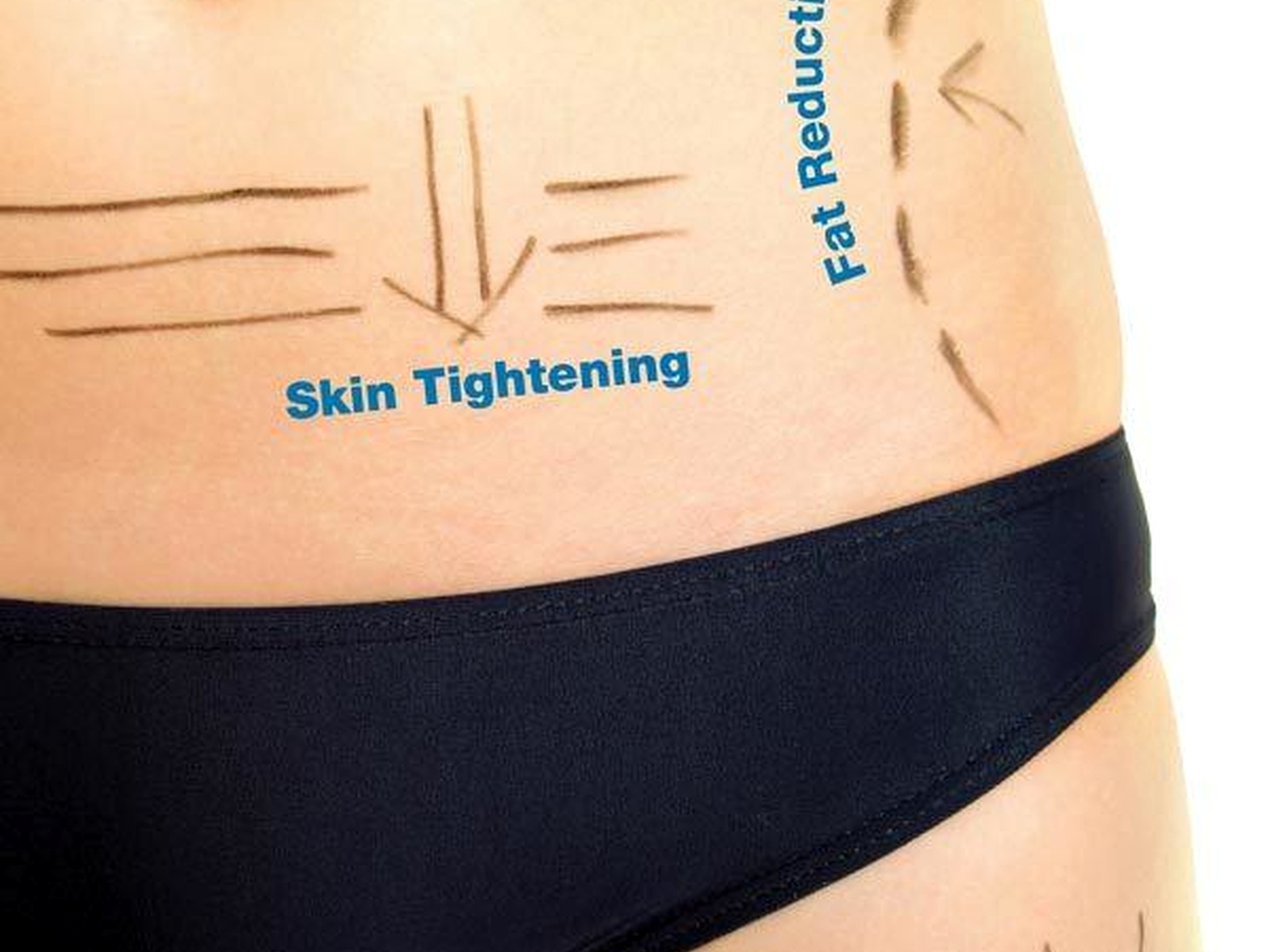 Body-contouring consultation with treatment area measurements